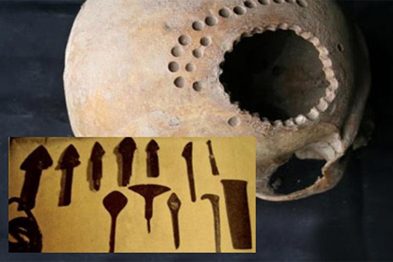 Medicina Inca by Andrade Santillán Leython Martín - Infogram