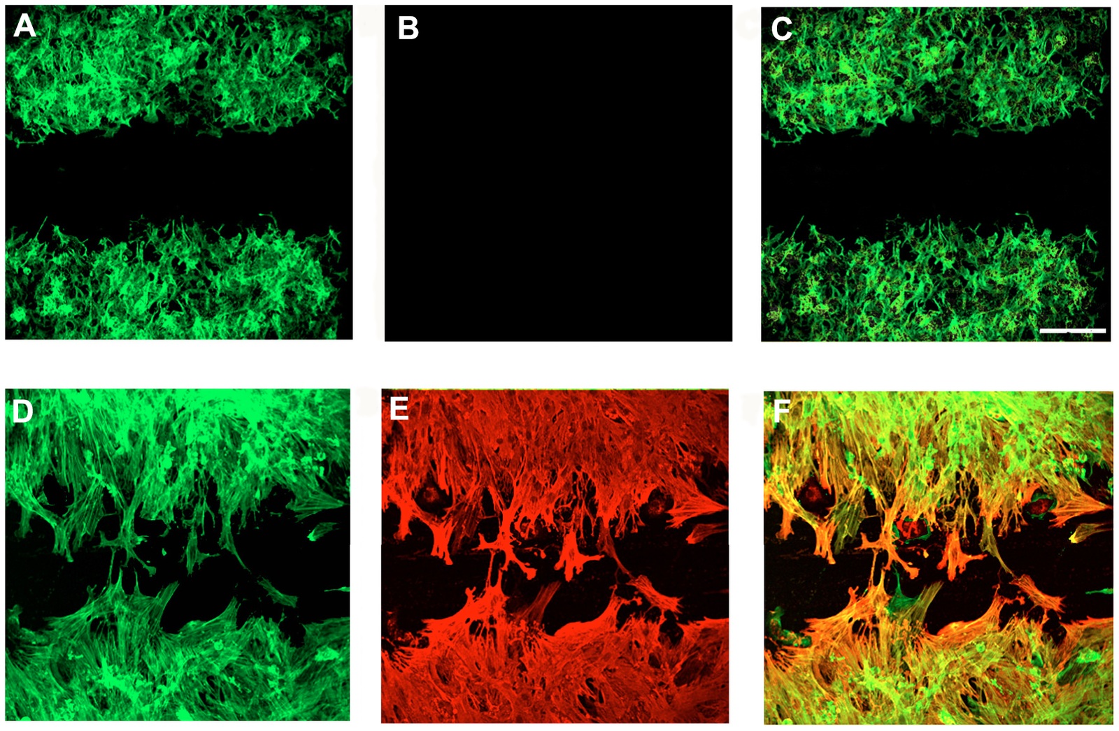 Acta2 Localization Smooth Muscle Cells by Meagan Vandersleen - Infogram