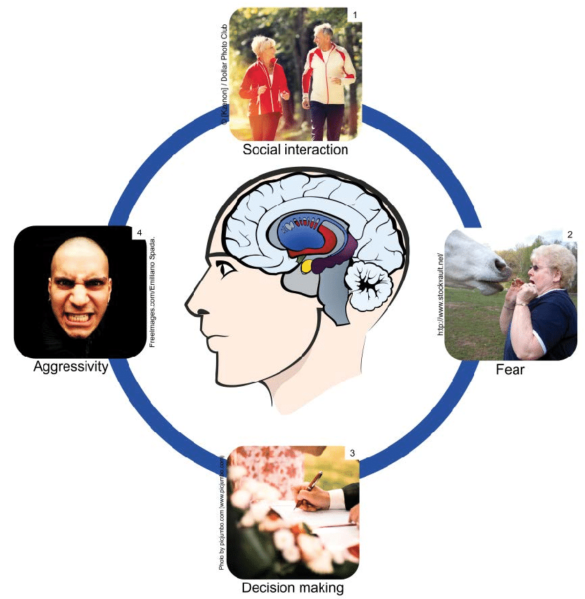 Amygdala Infographic by Stella Duffee - Infogram