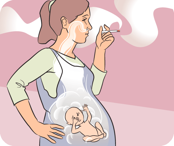 effects of cigarettes while pregnant cigarette smoking Figure 1 from Smoking Cessation in Pregnancy : Review of Current Strategies effects of cigarette smoking while