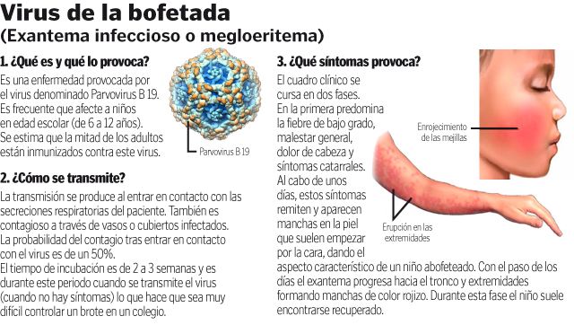 El 'virus de la bofetada' llega con la primavera