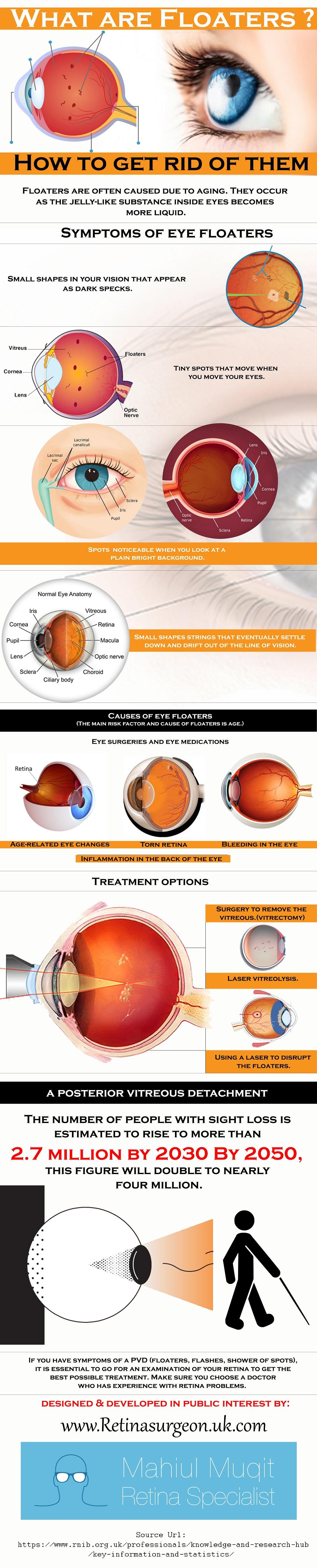 What are Floaters & How to get rid of them? by Retina Surgeon - Infogram