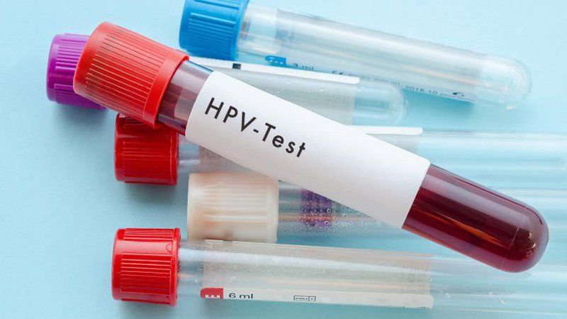 Xét nghiệm hpv ở đâu? Chi phí và quy trình thực hiện by Sức khỏe ...