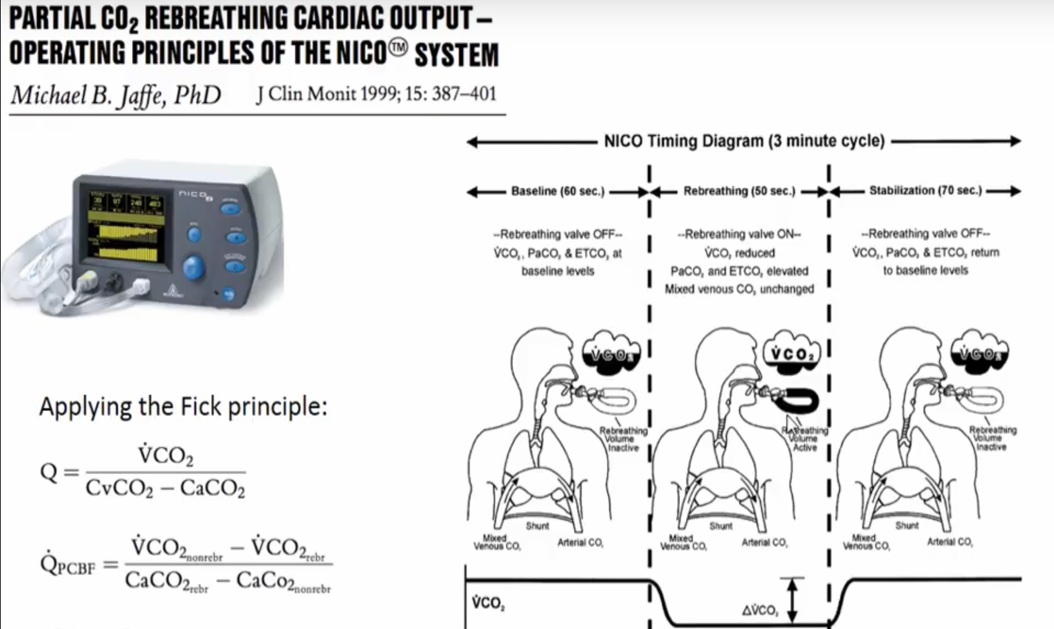Non-Invasive Continuous Cardiac Output Monitoring by KAY DAL - Infogram