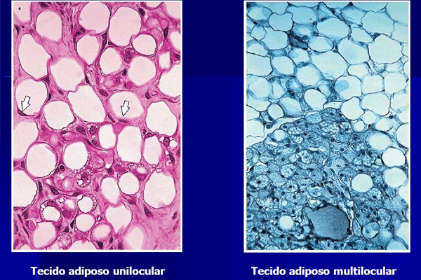 Tecido Conjuntivo Adiposo 652568tecido Conjuntivo Adiposo