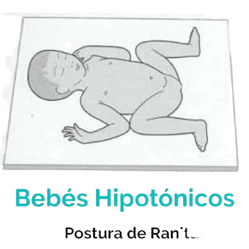 Síndrome Hipotónico by Daniela Cuevas - Infogram