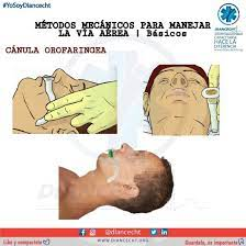 METODOS EN LA VIA AEREA By Abril Estefan a Gonzalez Duran Infogram metodos-en-la-via-aerea-by-abril-estefan-a-gonzalez-duran-infogram